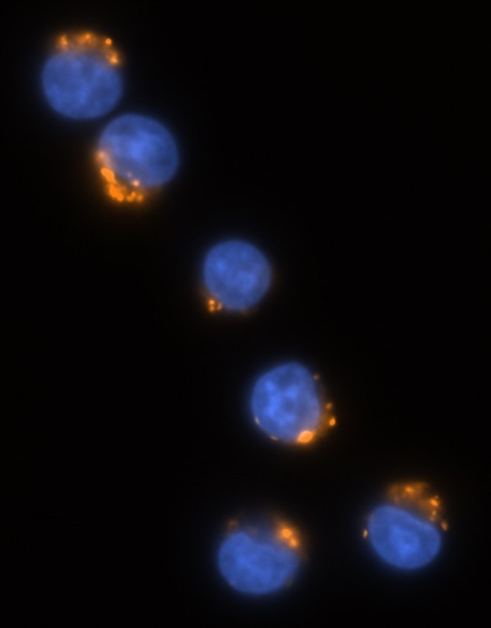 Hoechst, JC-1 - Jurkat T cells